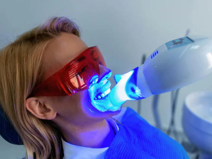 Teeth whitening in Bowling Green, KY at Precision Dental.