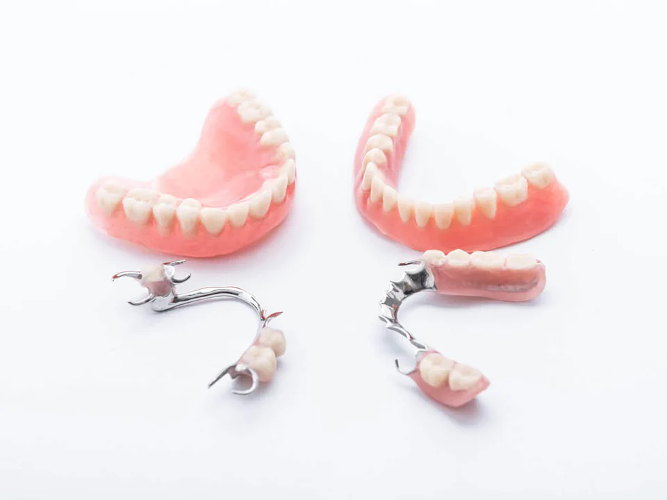 Partial and full dentures in Bowling Green, KY at Precision Dental.