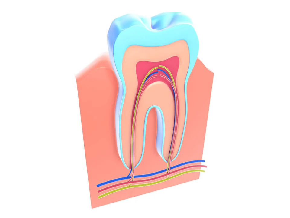 Root canal treatment in Bowling Green, KY at Precision Dental.