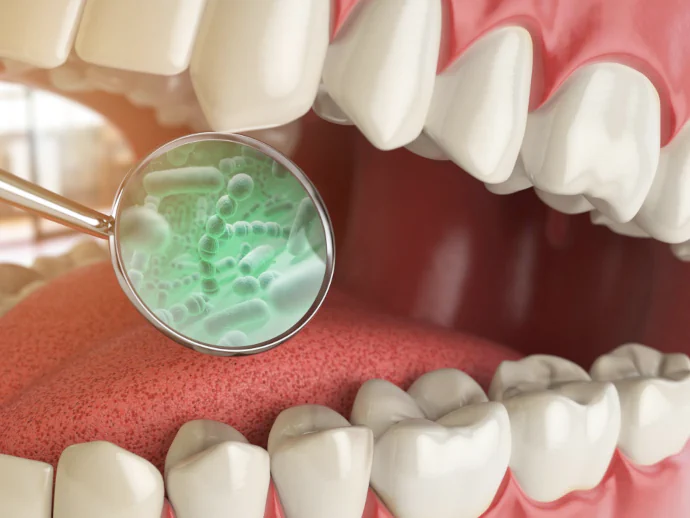 Bad breath treatment in Bowling Green, KY at Precision Dental.