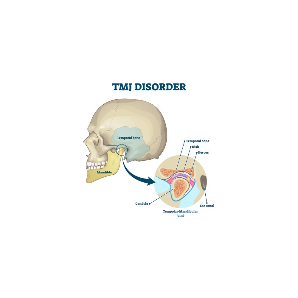 A labeled medical illustration of a human skull emphasizing the Temporomandibular Joint (TMJ). Key features include the temporal bone, mandible, and an inset close-up highlighting the TMJ area with labels for the disk, condyle, nerves, and ear canal.
