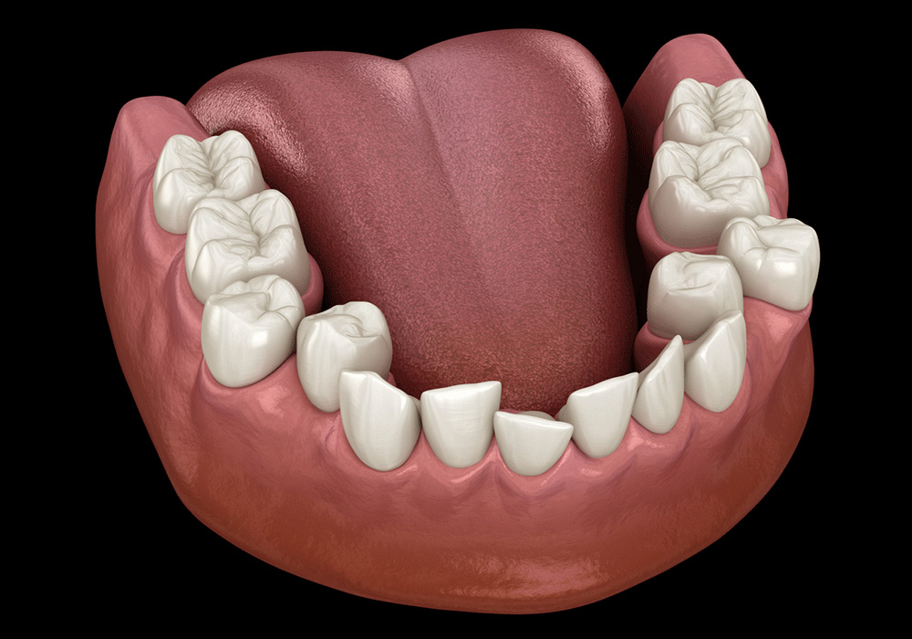 A 3D rendering of the lower jaw showing the tongue and teeth. The image clearly displays the molars and incisors, with the tongue positioned behind the teeth, making it useful for educational purposes in dentistry and anatomy.
